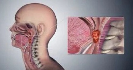 ڰҲ֢